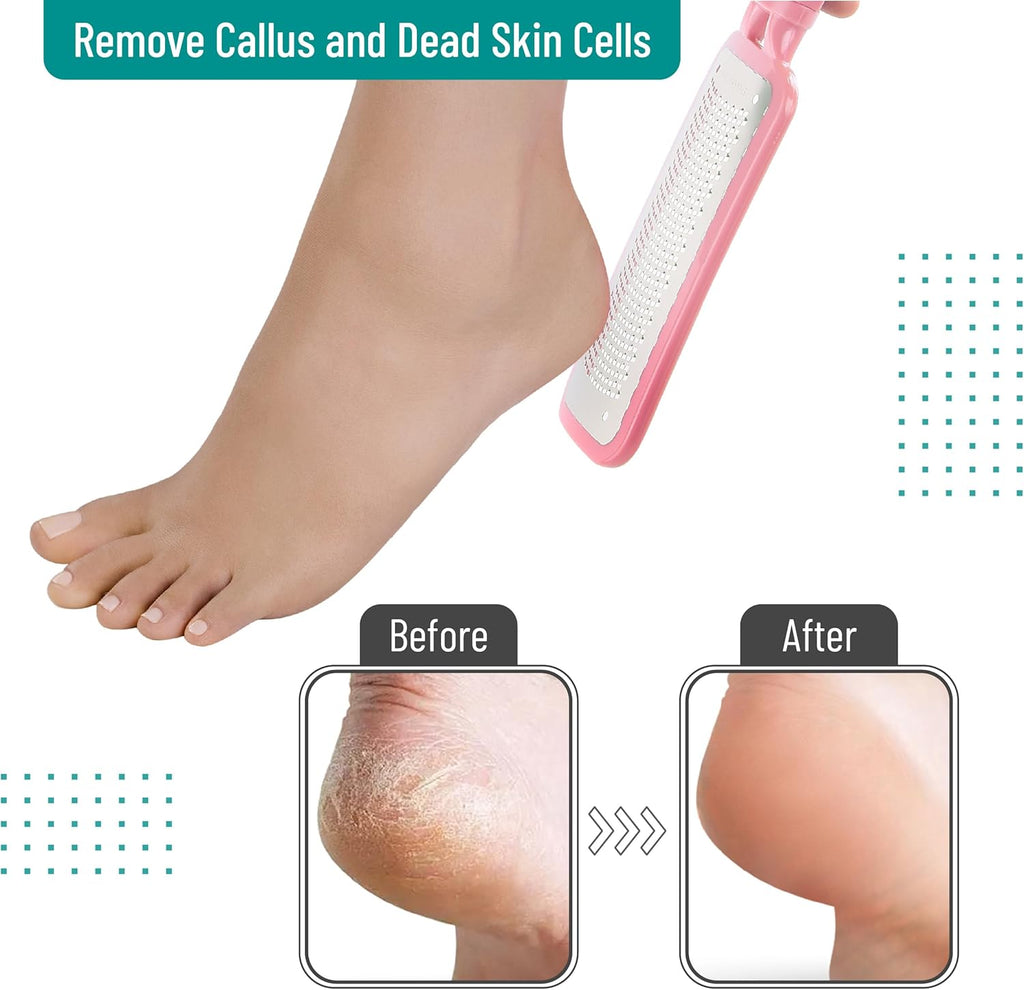 Slick Foot File Callus Remover - Pink Foot Scraper & Rasp for Dead Skin, Heel Scrubber
