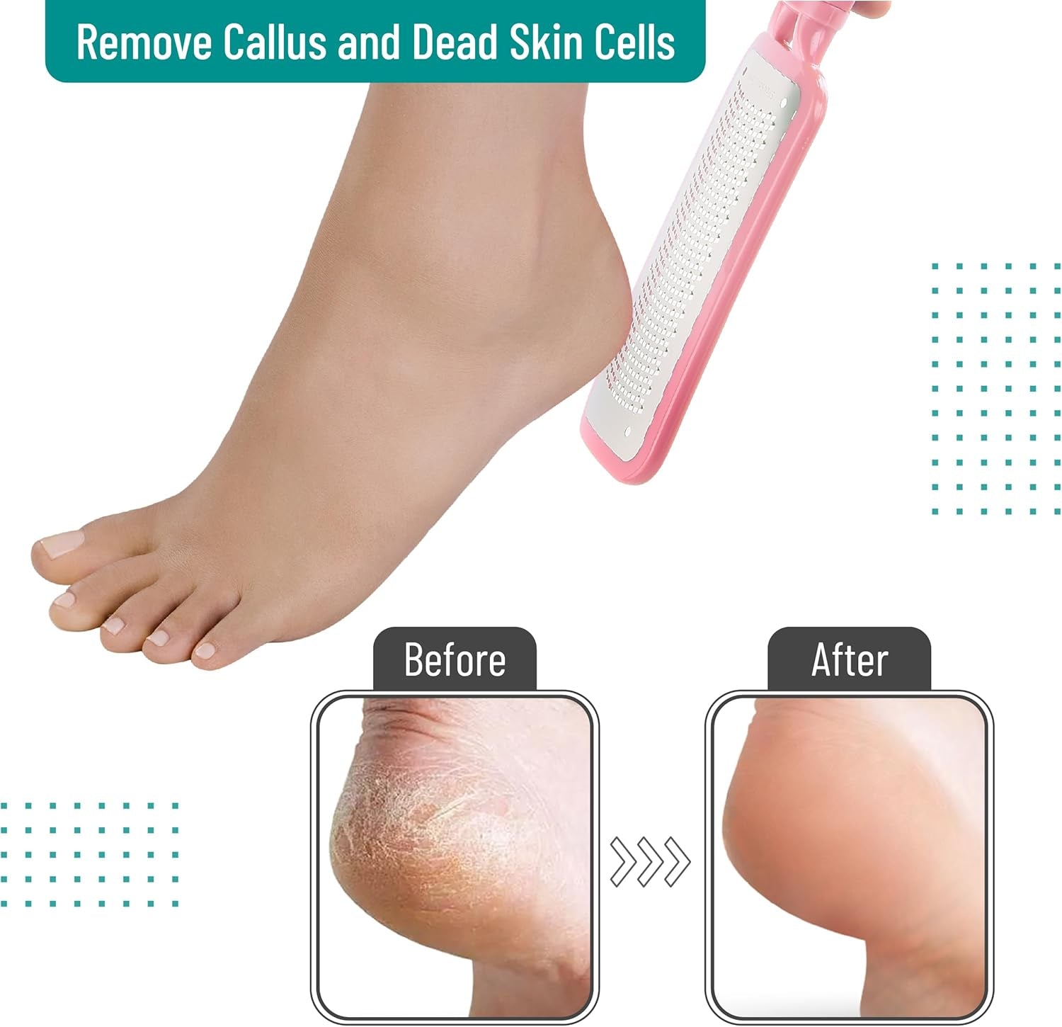 Slick Foot File Callus Remover - Pink Foot Scraper & Rasp for Dead Skin, Heel Scrubber